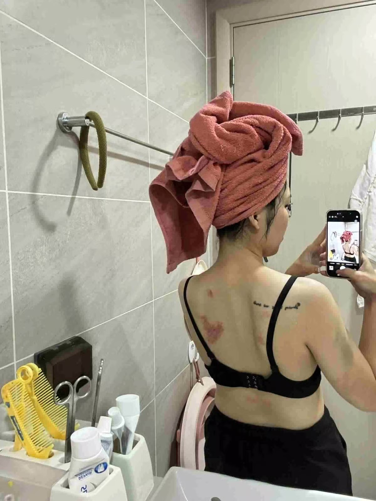 Hà Nội: Chồng đánh vợ thủng màng nhĩ, chấn động não ngay trước mắt hàng xóm- Ảnh 2.