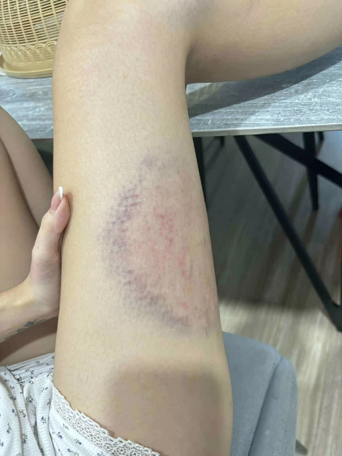 Hà Nội: Chồng đánh vợ thủng màng nhĩ, chấn động não ngay trước mắt hàng xóm- Ảnh 3.