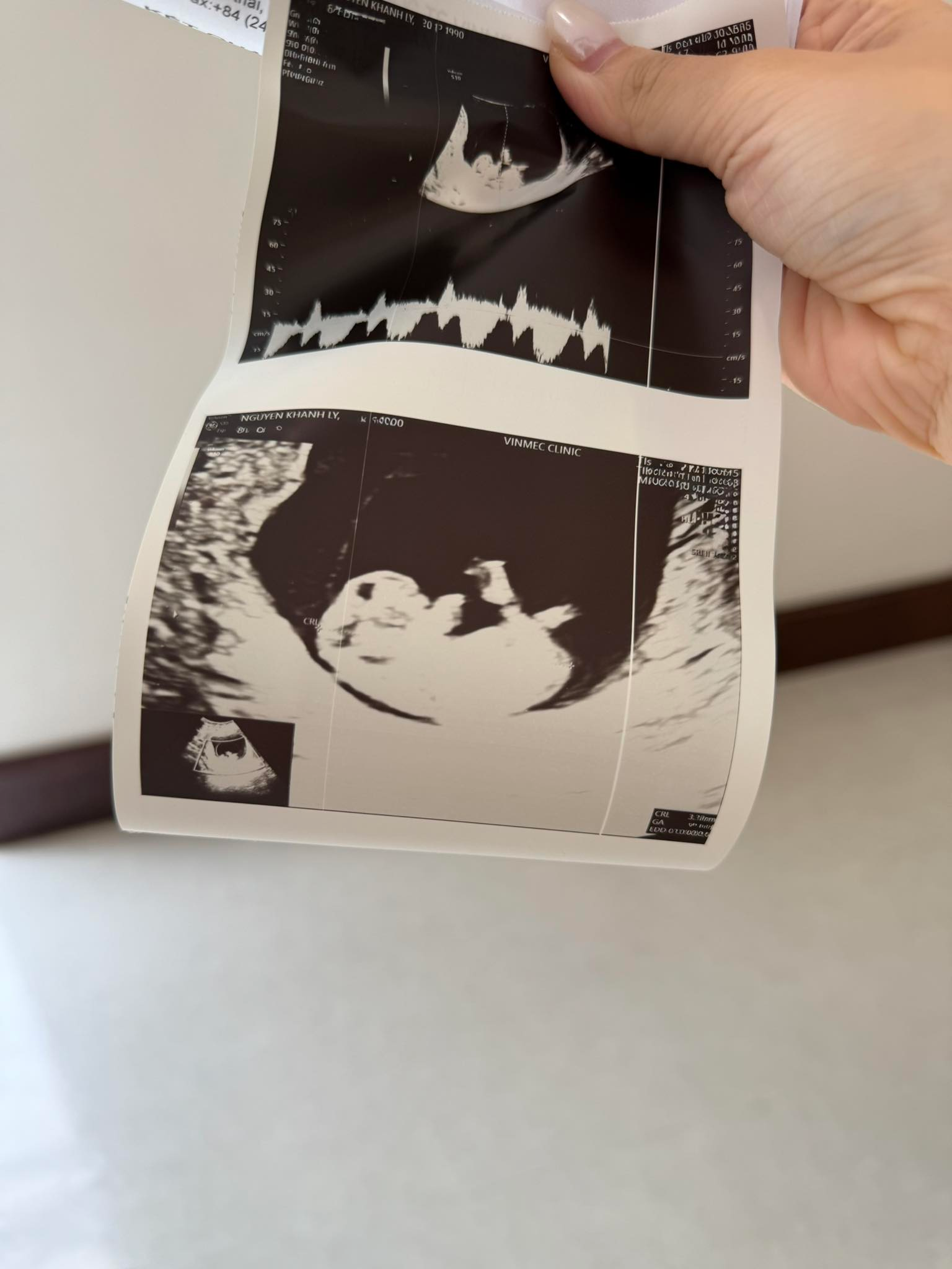 Hạnh phúc viên mãn: Hotmom Ly Kute khoe tin vui mang thai bé thứ 3- Ảnh 2. Hạnh phúc viên mãn: Hotmom Ly Kute khoe tin vui mang thai bé thứ 3- Ảnh 2.