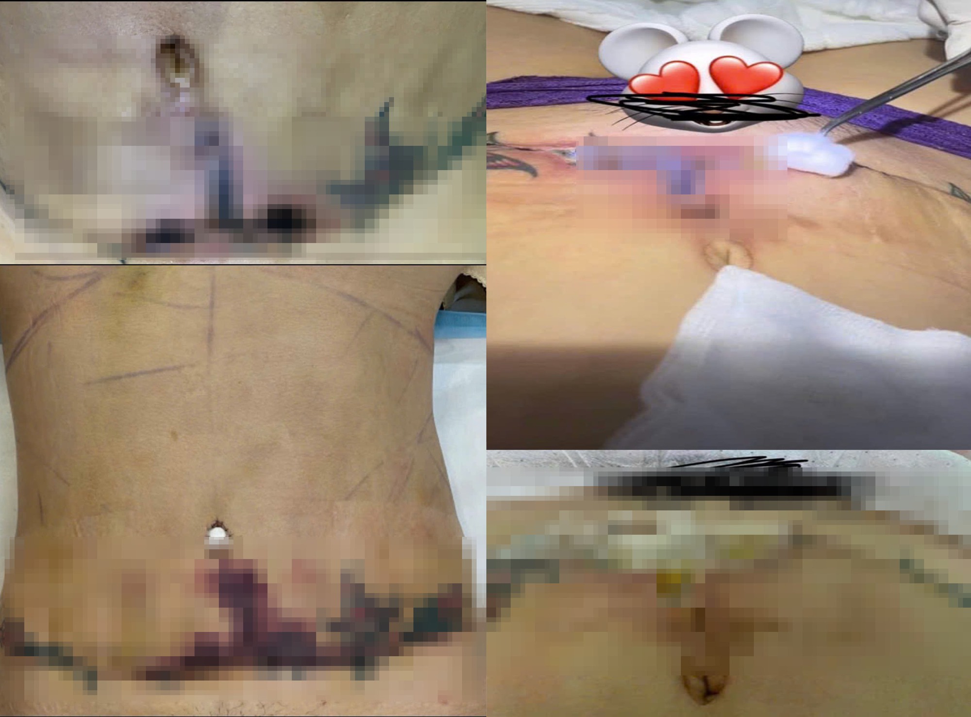 Sau điều tra Góc khuất "công nghệ" thẩm mỹ: Thêm một nữ nạn nhân tố Bệnh viện Thẩm mỹ JT Angel- Ảnh 2.