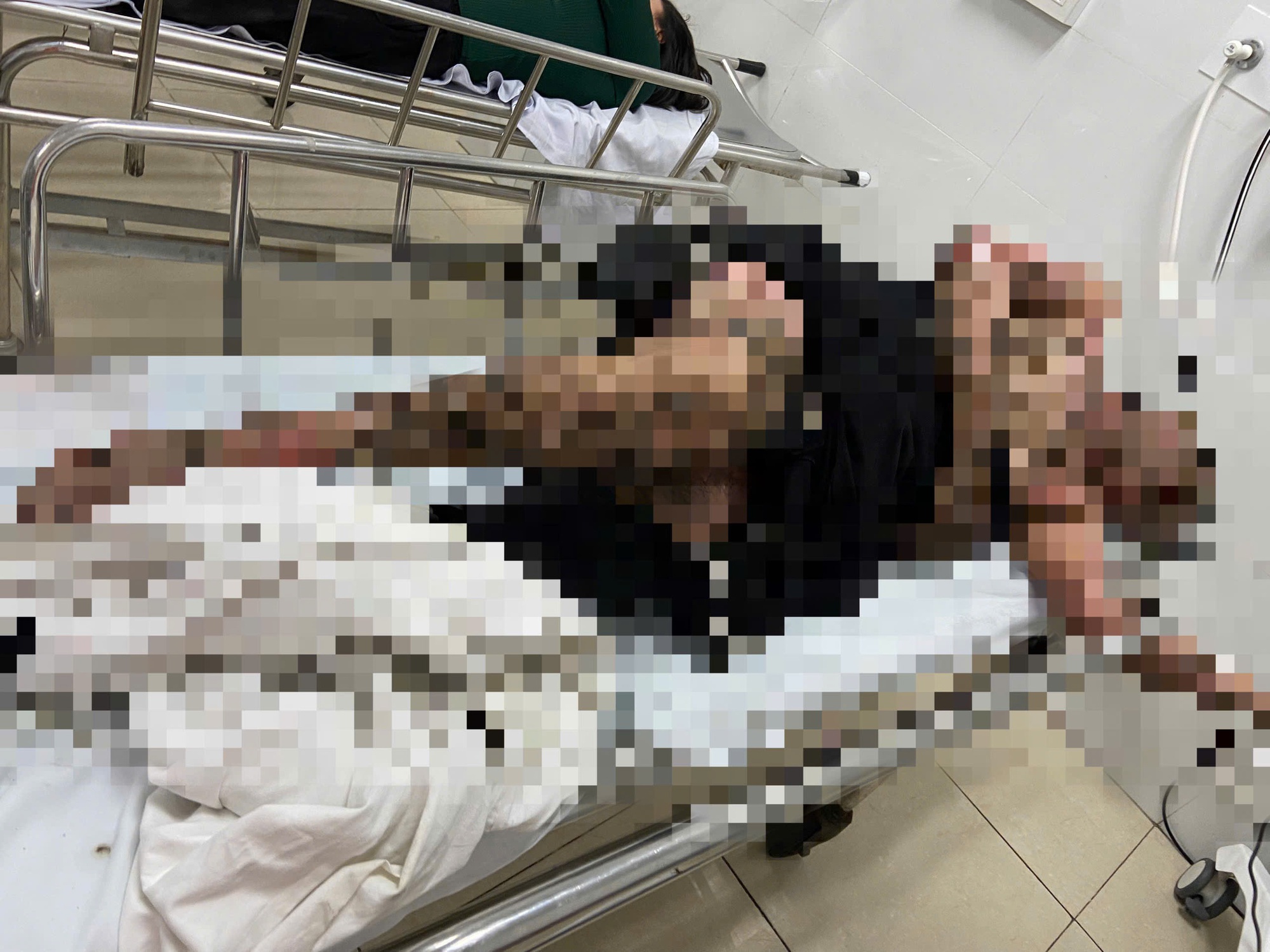 Bị Bỏng Toàn Thân Khi Quăng Câu Vướng Vào Dây Điện- Ảnh 1.