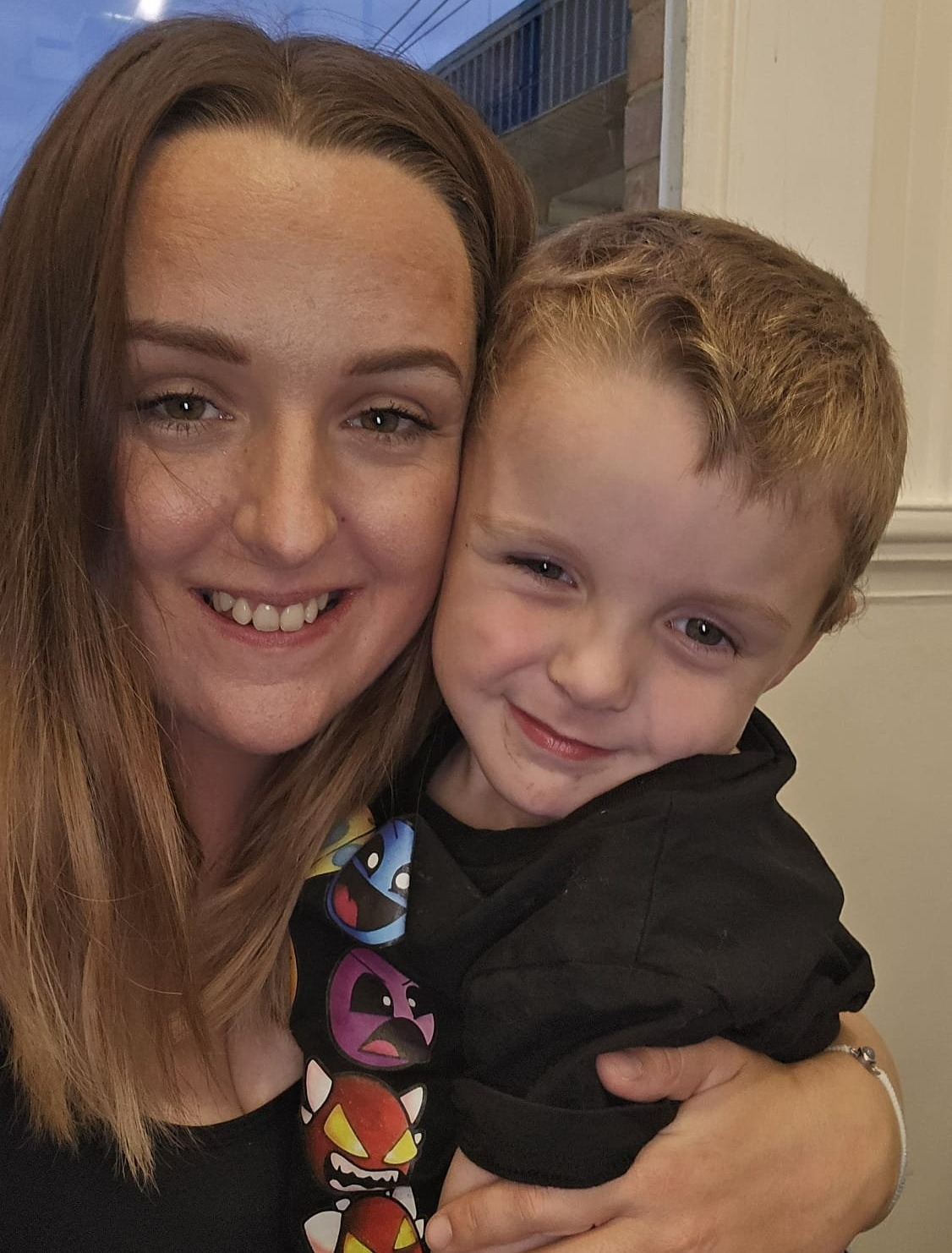 Bé trai 5 tuổi bị chó dữ tấn công khi đang đi dạo ở công viên- Ảnh 1. Bé trai 5 tuổi bị chó dữ tấn công khi đang đi dạo ở công viên- Ảnh 1.