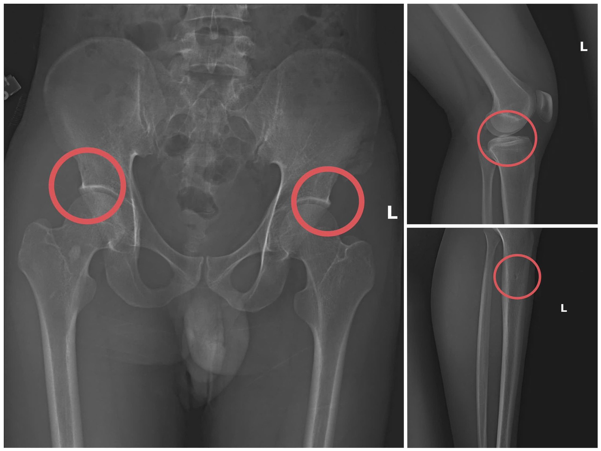Cựu Cán Bộ Y Tế Cầm Đầu Đường Dây Chuyên Dùng Búa Đập Vỡ Xương, Chiếm Đoạt Tiền Bảo Hiểm- Ảnh 2.