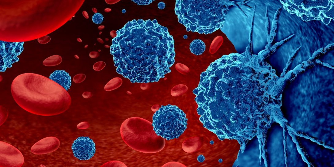 Cảnh báo 2 thực phẩm "châm ngòi" mạnh nhất cho ung thư - không phải đường- Ảnh 1. Cảnh báo 2 thực phẩm "châm ngòi" mạnh nhất cho ung thư - không phải đường- Ảnh 1.