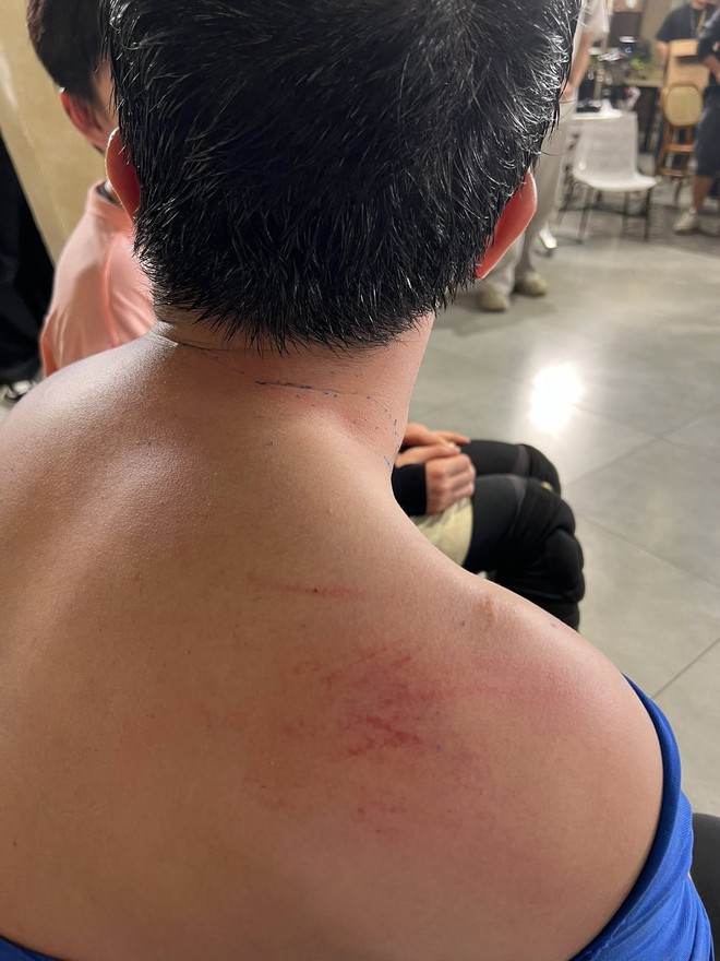 Chưa bao giờ thấy Trấn Thành tơi tả đến mức độ này- Ảnh 8. Chưa bao giờ thấy Trấn Thành tơi tả đến mức độ này- Ảnh 8.