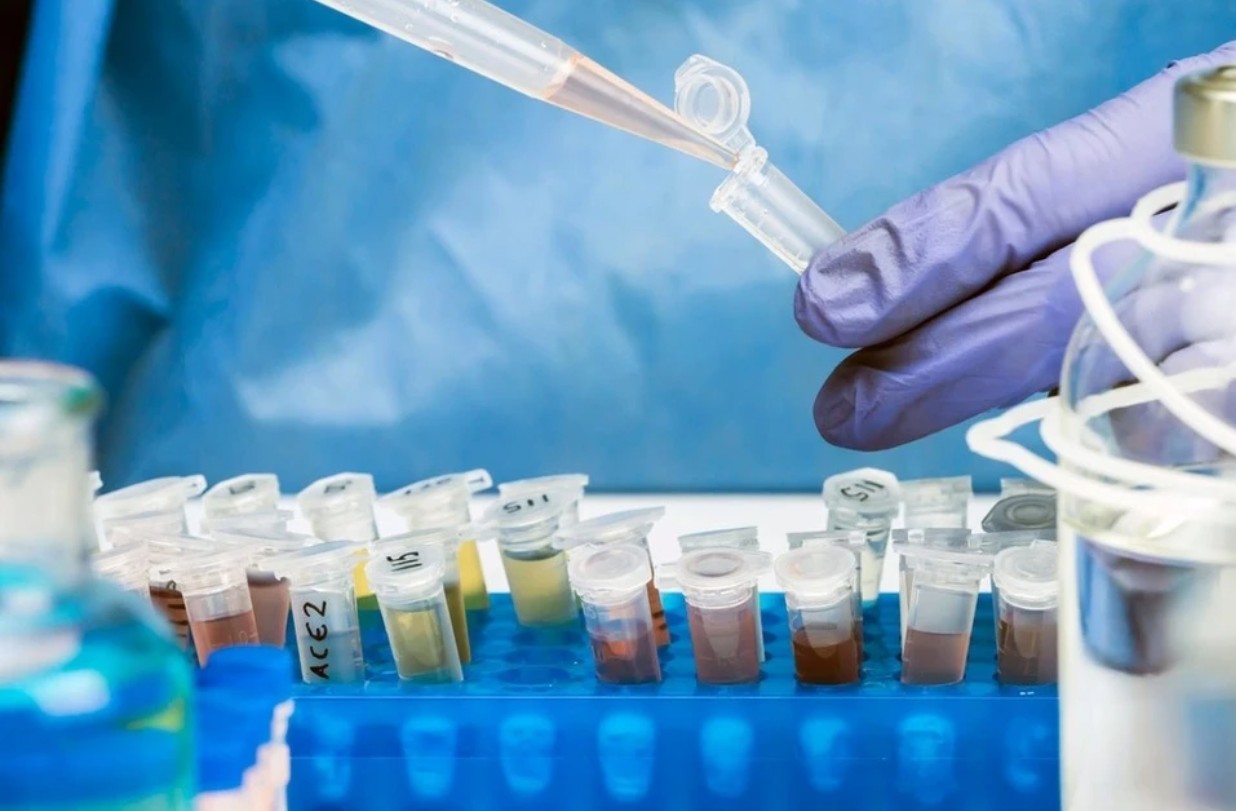 WHO báo động loại virus tái xuất sau 30 năm, gây liệt vĩnh viễn hoặc tử vong, đặc biệt ở trẻ em dưới 5 tuổi- Ảnh 1. WHO báo động loại virus tái xuất sau 30 năm, gây liệt vĩnh viễn hoặc tử vong, đặc biệt ở trẻ em dưới 5 tuổi- Ảnh 1.