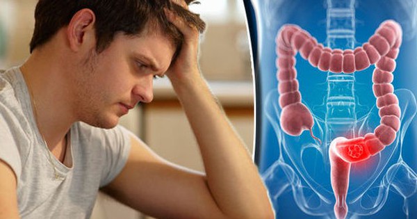 Ngày Càng Nhiều Người Trẻ Mắc Ung Thư Đại Trực Tràng, Bác Sĩ Chỉ Đích Danh 1 Triệu Chứng Rất Hay Bị Bỏ Sót