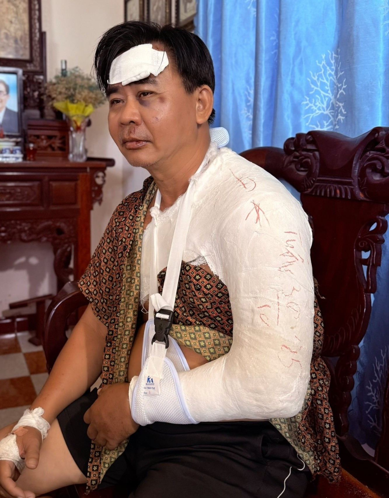 Tình trạng nghệ sĩ Chánh Thuận sau tai nạn xe - Ảnh 1.