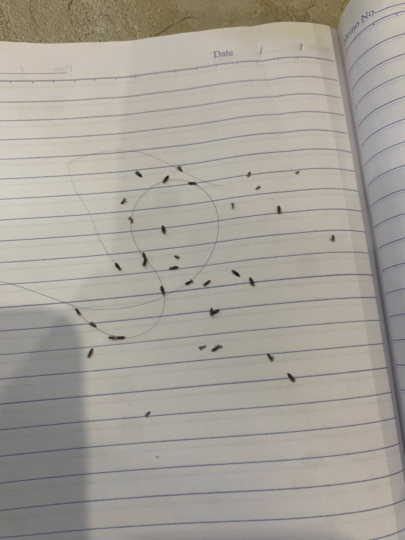 Sốc: 60 con chấy b&ograve; ra từ m&aacute;i t&oacute;c của 