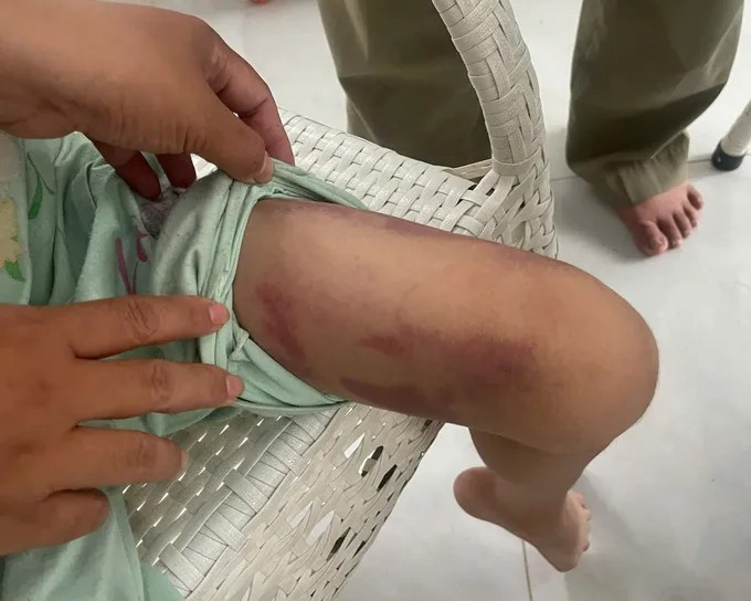 Bắt tạm giam hai đối tượng trong vụ b&eacute; 9 tuổi bị mẹ ruột bạo h&agrave;nh- Ảnh 1.