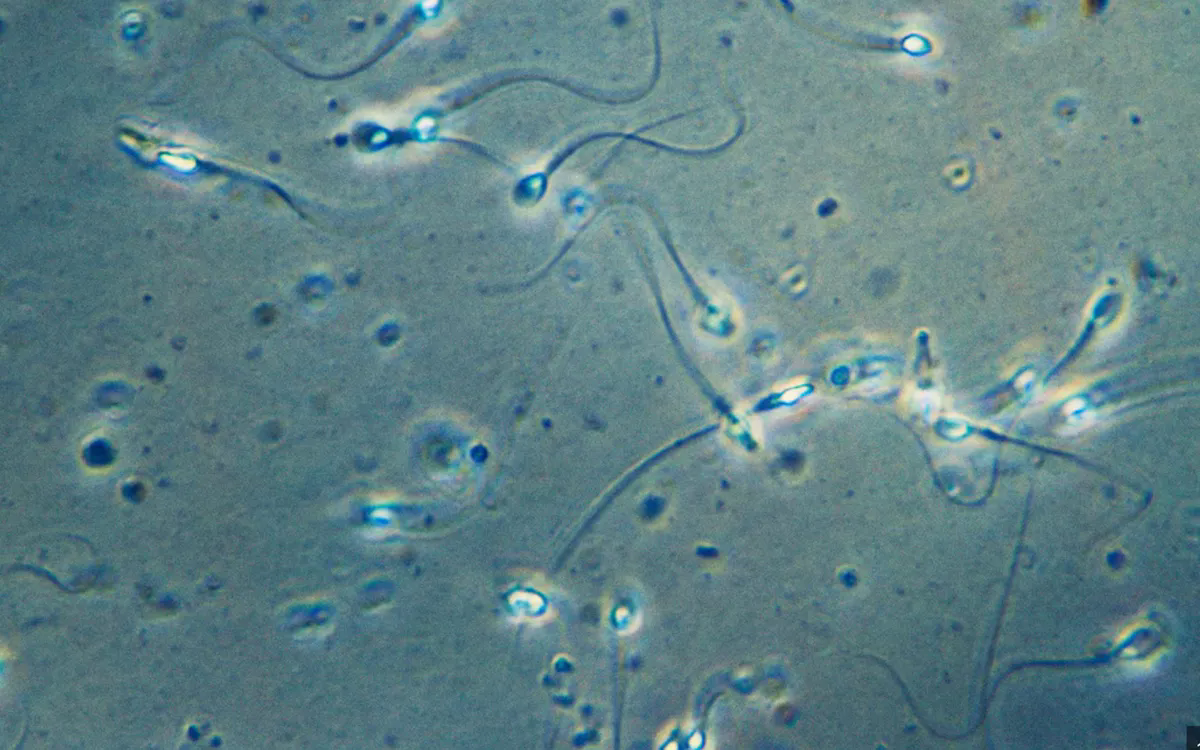 Hình ảnh tinh trùng dưới kính hiển vi (Ảnh minh họa: Getty Images)