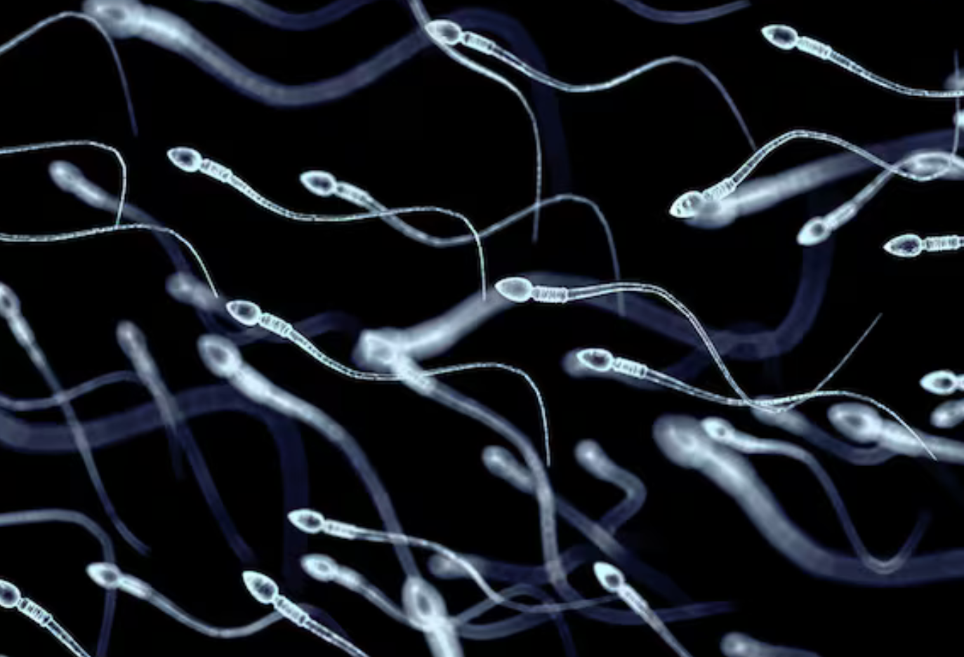 Ca mang thai đầu tiên trên thế giới nhờ phương pháp thu hồi tinh trùng do AI hỗ trợ- Ảnh 2.