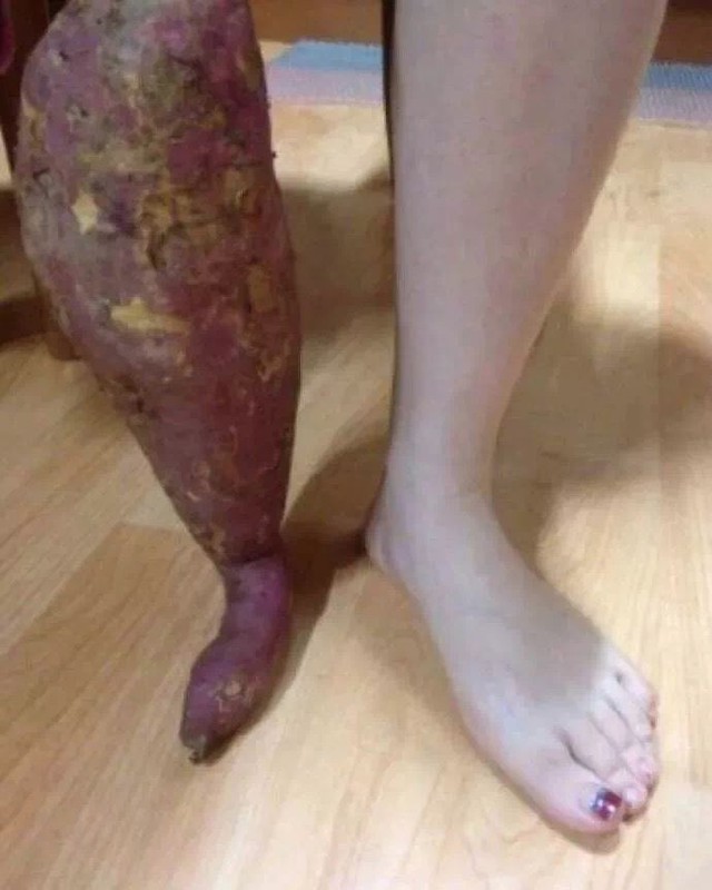 Bức ảnh l&agrave;m 50 triệu người bật cười, nhưng lại khiến mẹ t&ocirc;i kh&oacute;c nức nở- Ảnh 1.