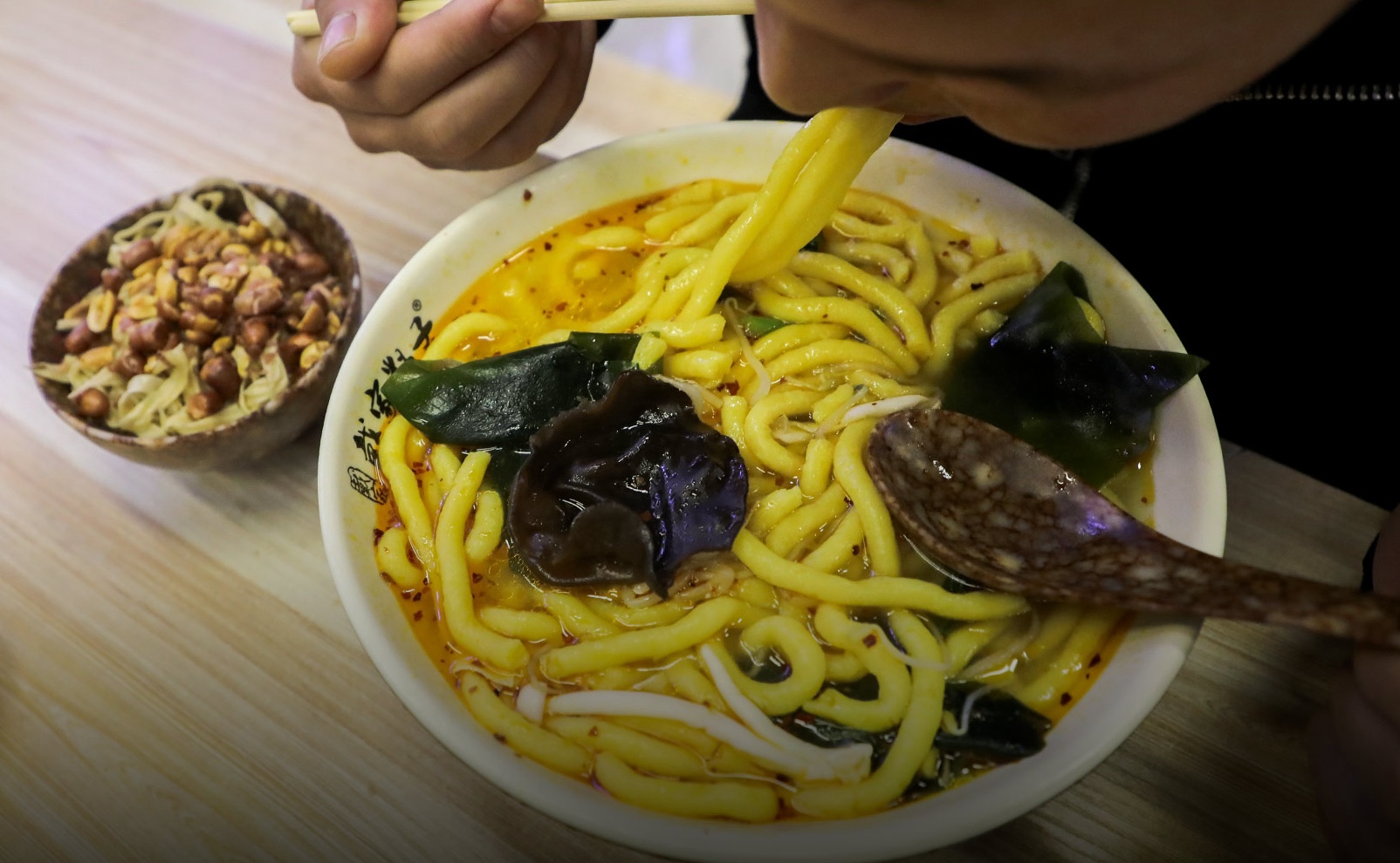 Người phụ nữ 40 tuổi suy gan và suy thận nguy kịch chỉ vì 1 bát mì, bác sĩ hoảng hốt: Người phụ nữ 40 tuổi suy gan và suy thận nguy kịch chỉ vì 1 bát mì, bác sĩ hoảng hốt: