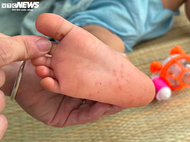 Tay Chan Mieng 2 14133479 1763726523749 1763726524514330353130