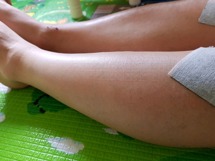 4 bất thường ở chân là dấu hiệu ung thư phổi dù nói ra có nhiều người CHẲNG CHỊU TIN!- Ảnh 1.