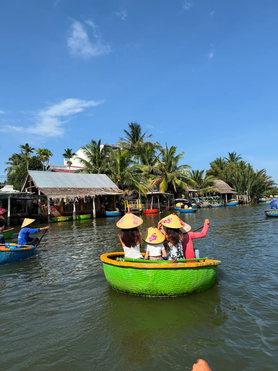 Mỹ nhân phim giờ vàng liều lĩnh "dao kéo" thu ngắn nhân trung, giờ gánh di chứng đến suốt đời- Ảnh 5.