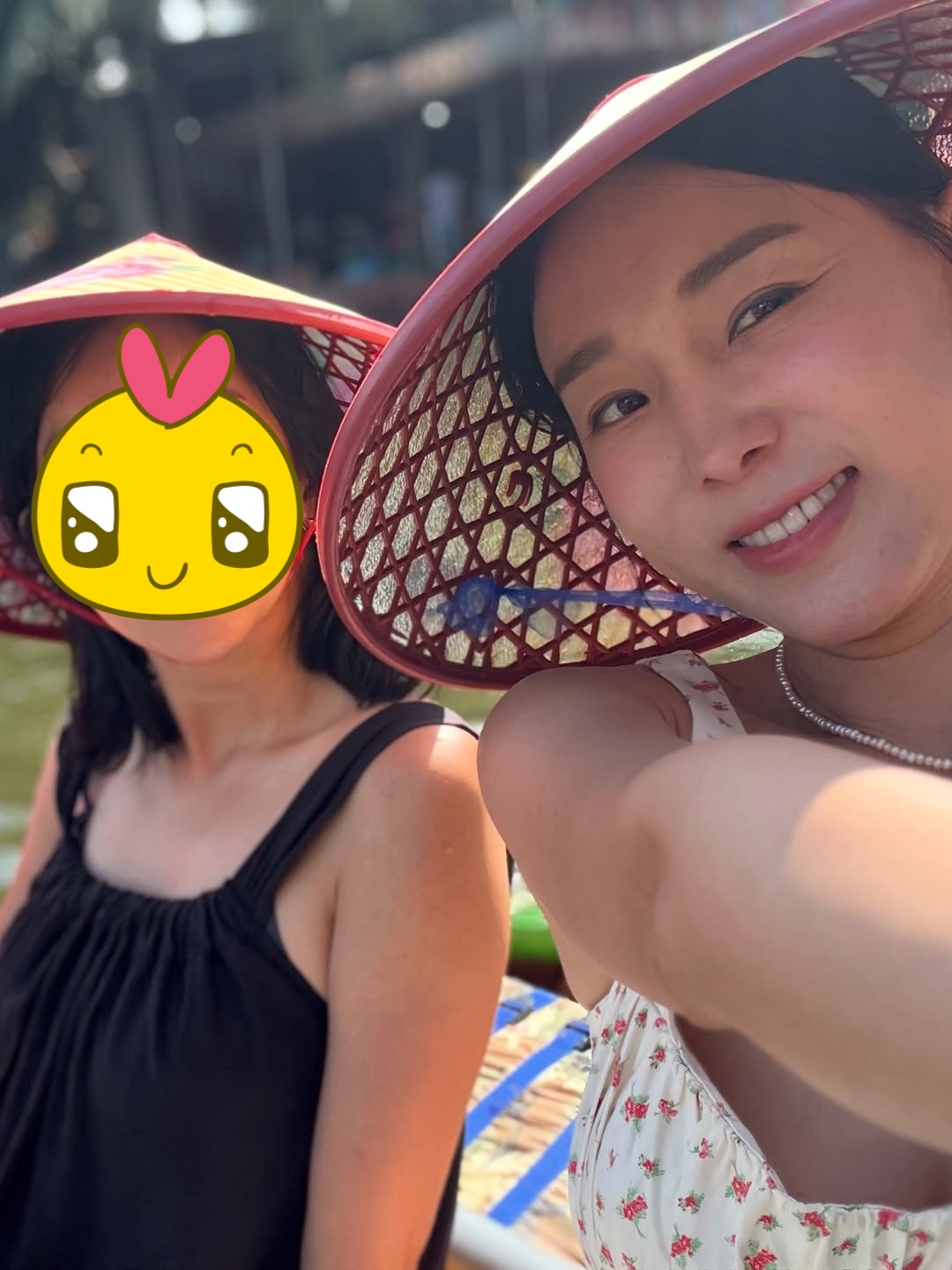 Mỹ nhân phim giờ vàng liều lĩnh "dao kéo" thu ngắn nhân trung, giờ gánh di chứng đến suốt đời- Ảnh 4.