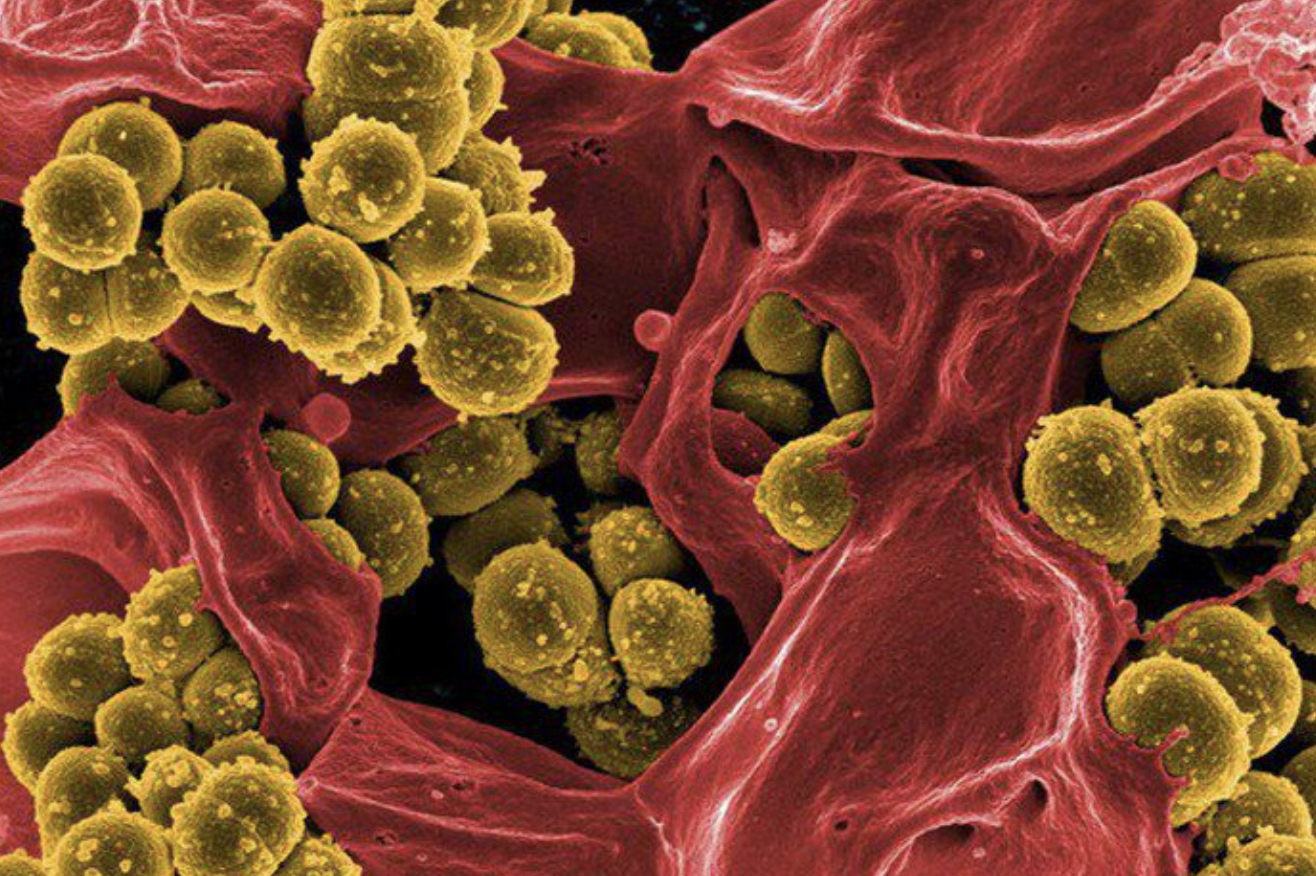 Vết thương do heo cắn khiến bé trai 14 tuổi nguy kịch- Ảnh 2.