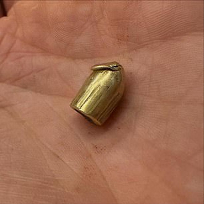 Nữ thần bóng chuyền thoát chết thần kì sau khi bị bắn trúng trong một vụ cướp- Ảnh 3.