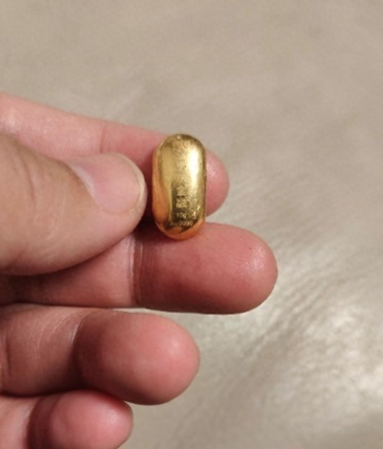 500.000 người theo dõi vụ cậu bé 11 tuổi nuốt nhầm miếng vàng 10g- Ảnh 1.