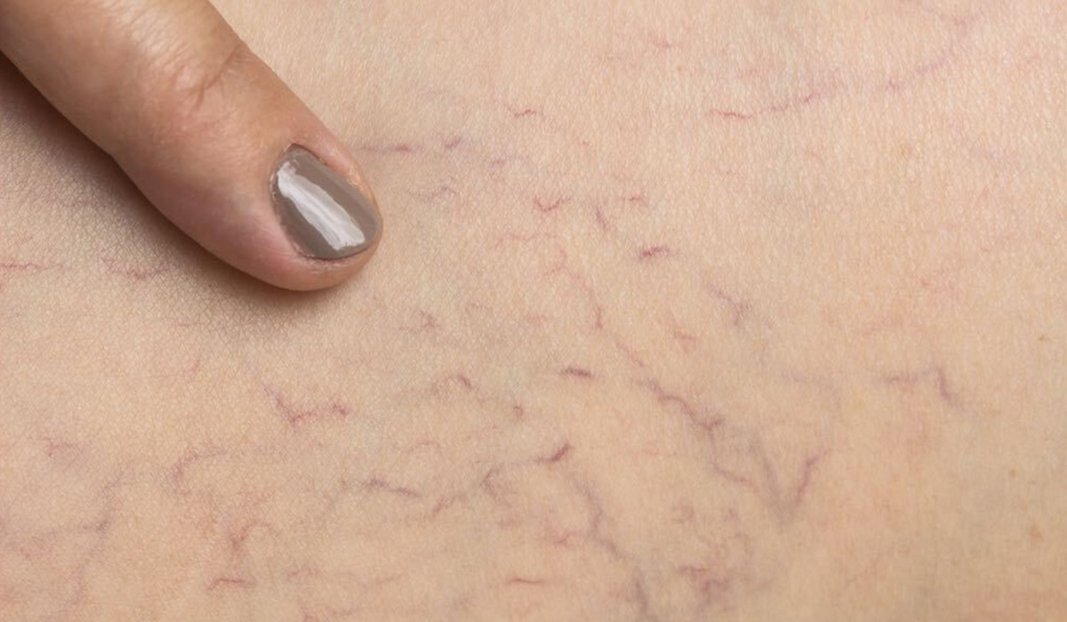 Nhìn tay và chân cũng có thể biết gan bị tổn thương hay không: Đây là 5 dấu hiệu cần lưu ý - Ảnh 4.