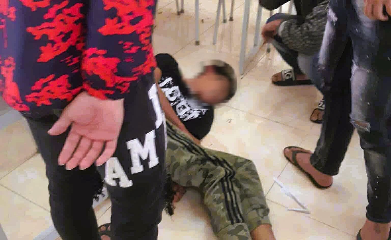 Nam Sinh Lớp 10 Bị Nhóm Bạn Cùng Trường Đánh Xuất Huyết Não, Tiên Lượng Xấu- Ảnh 1. Nam Sinh Lớp 10 Bị Nhóm Bạn Cùng Trường Đánh Xuất Huyết Não, Tiên Lượng Xấu- Ảnh 1.