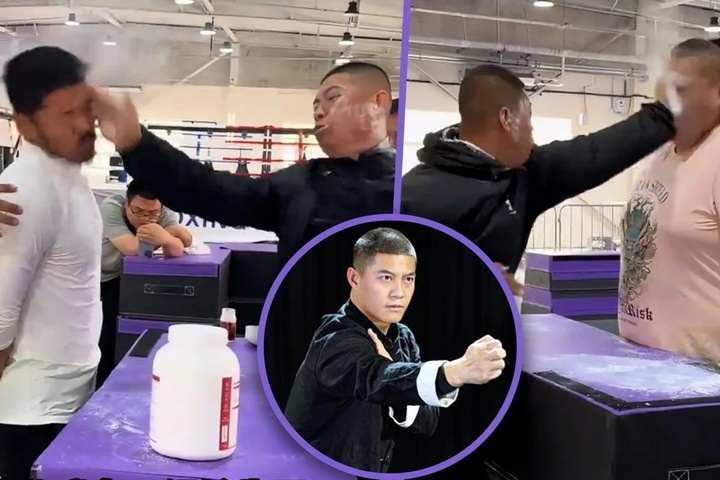 Đệ tử chân truyền môn võ 2000 năm của Trung Quốc bị tát méo mặt, khâu 5 mũi- Ảnh 3.