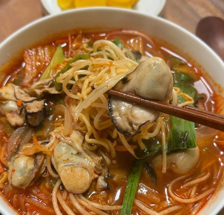 Cô Gái Sụt 15Kg, Dạ Dày Bị Liệt Vì Món Mì Hot Trend Bao Năm Giới Trẻ Việt Vẫn Cô Gái Sụt 15Kg, Dạ Dày Bị Liệt Vì Món Mì Hot Trend Bao Năm Giới Trẻ Việt Vẫn