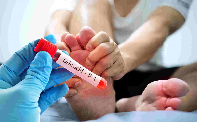 Axit Uric 6 1 1762230651890 17622306528721947683357