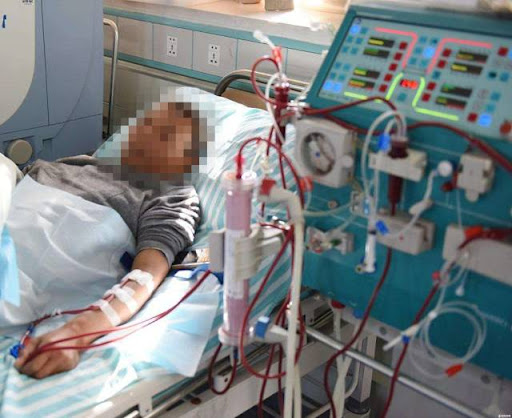 Thanh niên 20 tuổi thận teo nhỏ, mất chức năng vì bỏ qua 3 dấu hiệu cảnh báo- Ảnh 1.