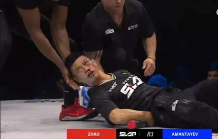 Đệ tử chân truyền môn võ 2000 năm của Trung Quốc bị tát méo mặt, khâu 5 mũi- Ảnh 2.