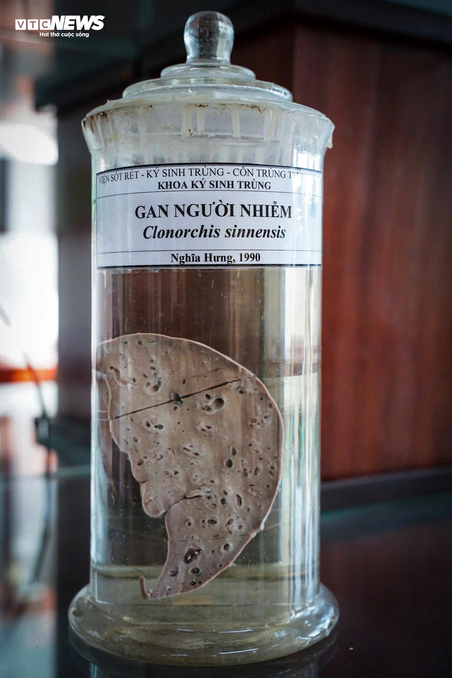 Bên Trong Bảo Tàng Lưu Giữ Những 'Kẻ Ký Sinh' Nguy Hiểm Nhất Với Con Người- Ảnh 6.