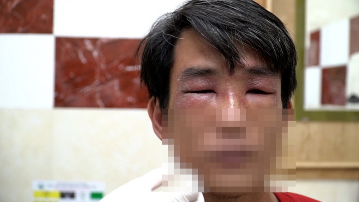 TP HCM vào mùa kiến ba khoang: cảnh báo người dân kiểm tra chăn màn- Ảnh 1. TP HCM vào mùa kiến ba khoang: cảnh báo người dân kiểm tra chăn màn- Ảnh 1.