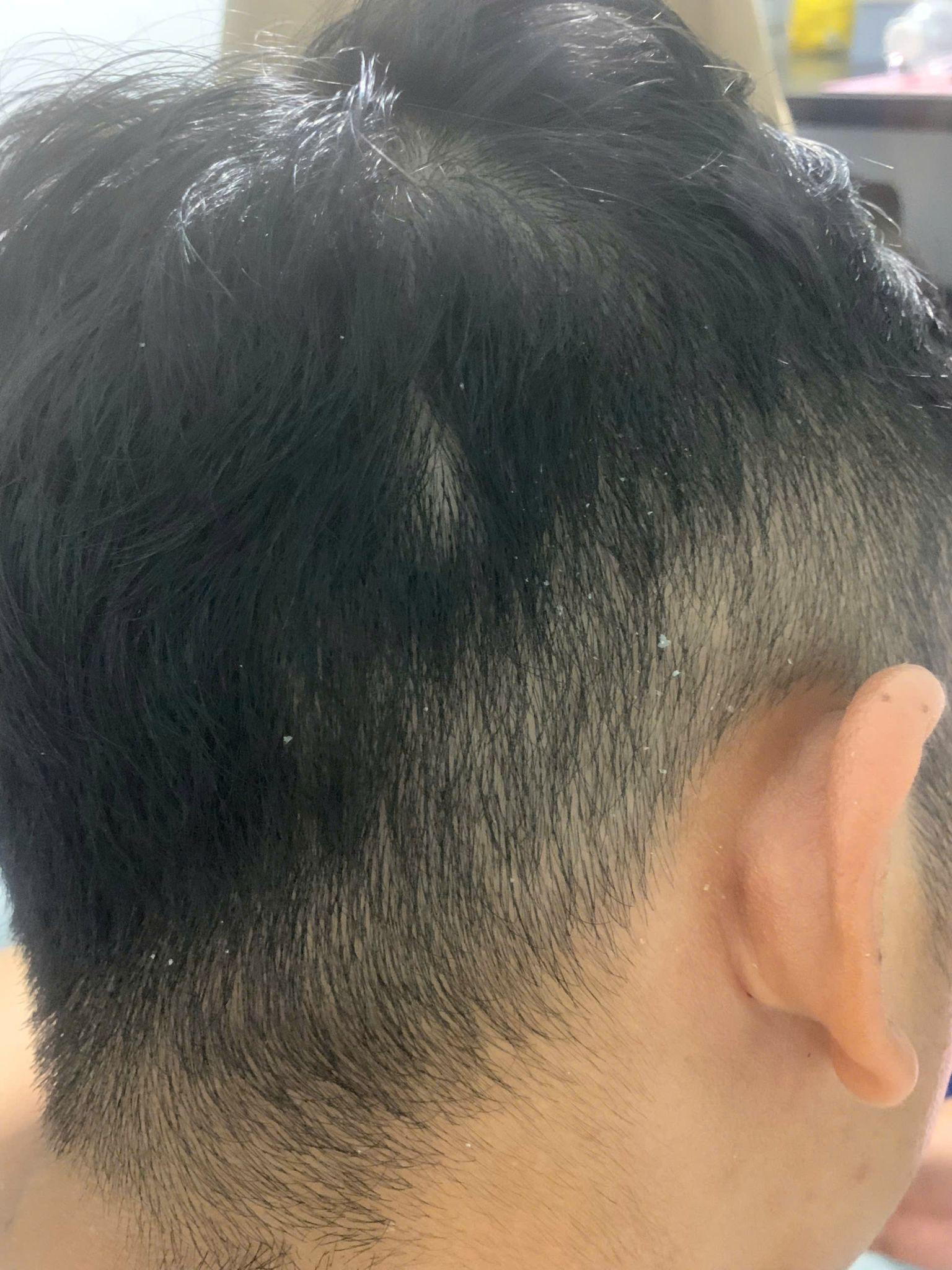 Antisol &ndash; bước tiến mới trong xu hướng dầu gội dược liệu sạch g&agrave;u- Ảnh 2.