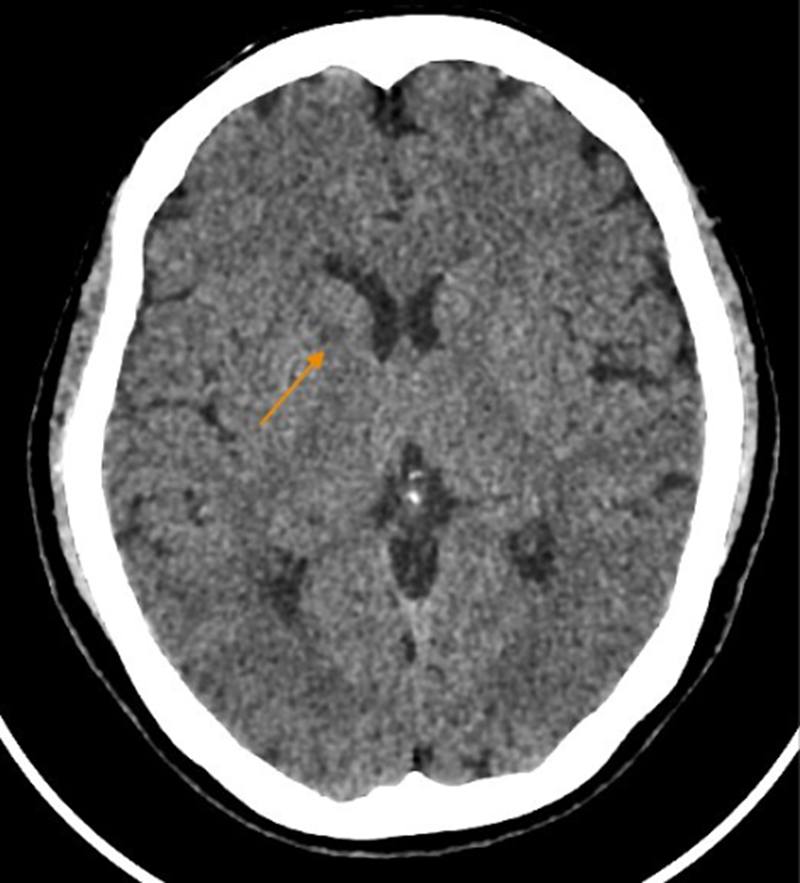 Đột quỵ thường "rình rập" những người KHÔNG làm điều này khi thức dậy - Ảnh 1.