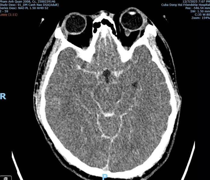 Z7313769755118C1A654320037711849553934 1765449082164 176544908273122398533