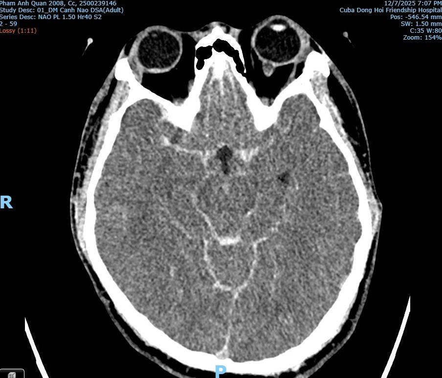 Bác sĩ bất ngờ lý giải nguyên nhân tử vong của thiếu niên xô xát ở quán bida Ba Đồn - Ảnh 2. Bác sĩ bất ngờ lý giải nguyên nhân tử vong của thiếu niên xô xát ở quán bida Ba Đồn - Ảnh 2.