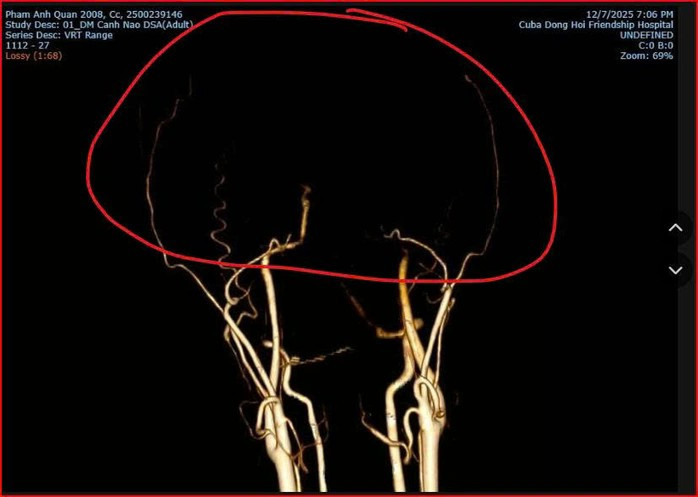 Z731377180781765431960836893077930 1765449082164 1765449082730481485322