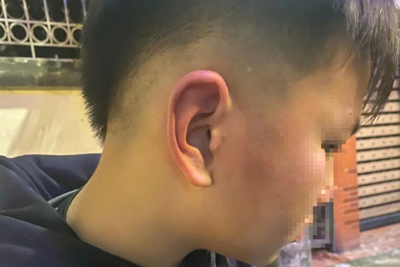 Pháp lý vụ bé trai 12 tuổi bị bố bạn đánh: Hành vi bạo lực trẻ em - Ảnh 1. Pháp lý vụ bé trai 12 tuổi bị bố bạn đánh: Hành vi bạo lực trẻ em - Ảnh 1.