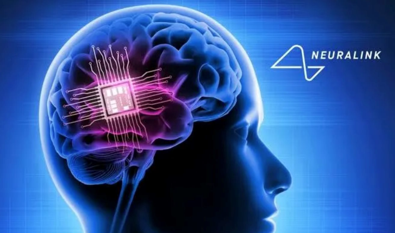 Neuralink của Elon Musk cấy chip vào não người chỉ trong 1 , 5 giây , an toàn và hiệu quả cao - Ảnh 2.