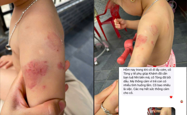 Nữ sinh lớp 8 bị bạn qu&acirc;y đ&aacute;nh, giật t&oacute;c k&eacute;o l&ecirc;: Hiệu trưởng chia sẻ do "m&acirc;u thuẫn trẻ con" - Ảnh 2.