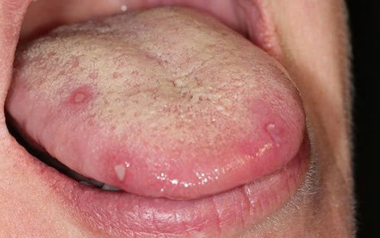 3A 1766014443851 1766014444199297254304