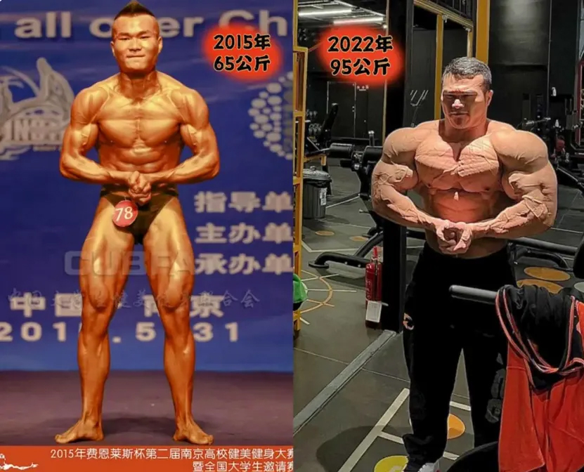 Vuong Con Qua Doi Do Benh Tim Mach1 1766021887713 17660218879931518506458