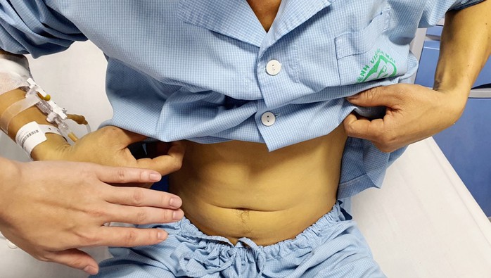 Uống Mật Cá Trắm Để Tăng Sinh Lực, Người Đàn Ông 38 Tuổi Nguy Kịch Img