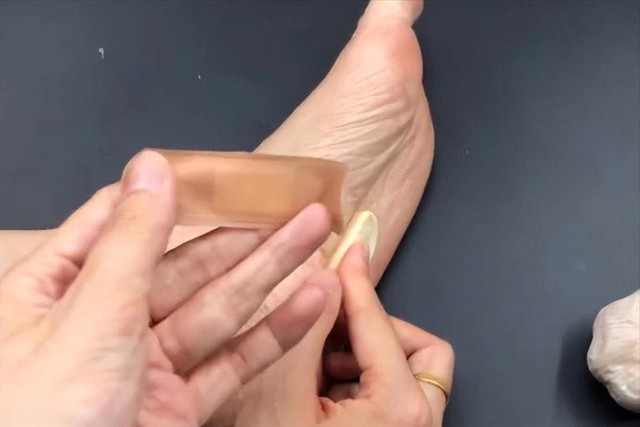 Người phụ nữ 56 tuổi dán tỏi vào lòng bàn chân suốt 6 tháng, kết quả khám sức khỏe khiến bác sĩ 