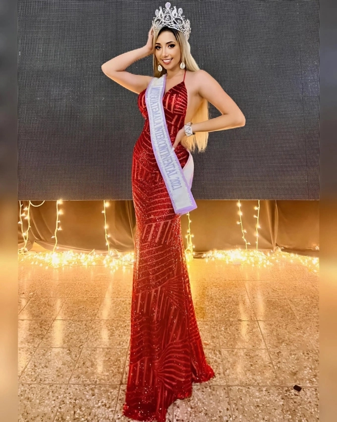 Hoa Hậu 28 Tuổi Qua Đời Vì Ung Thư Cổ Tử Cung: Bs Cảnh Báo Bệnh Đang Trẻ Hóa, Có Dấu Hiệu Này Phải Đi Khám- Ảnh 1.