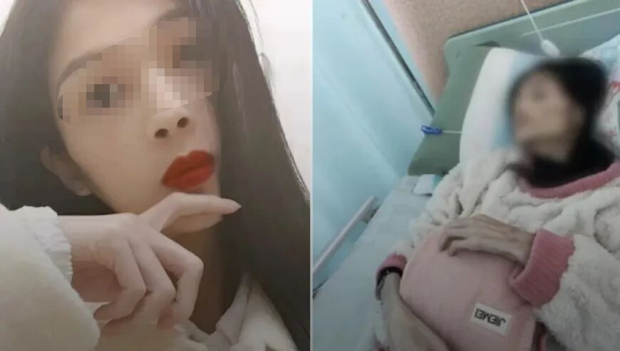 Nữ Tiktoker 27 tuổi qua đời vì chứng teo dạ dày, lúc cuối đời chỉ còn 17,5 kg: Mọi chuyện bắt đầu từ hoàn cảnh gia đình- Ảnh 1.