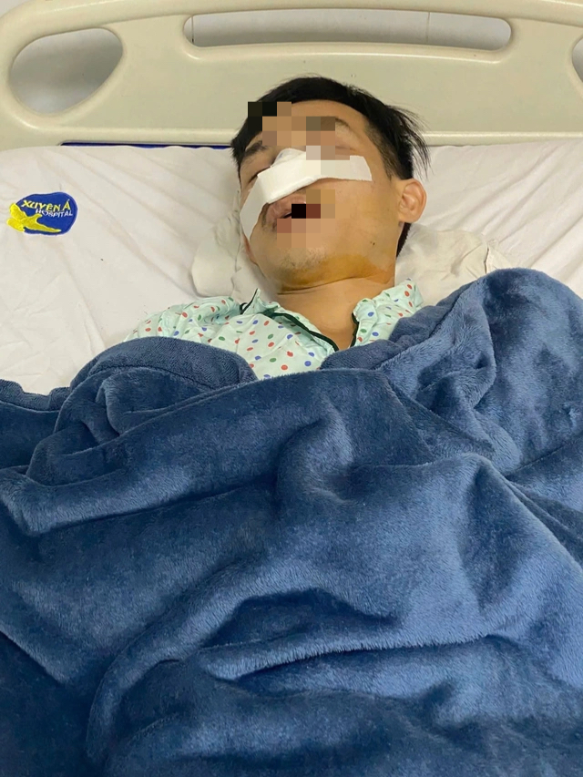 C&ocirc;ng an khẩn trương v&agrave;o cuộc vụ một người bị đ&aacute;nh g&atilde;y mũi ở Chợ đầu mối H&oacute;c M&ocirc;n - Ảnh 2.