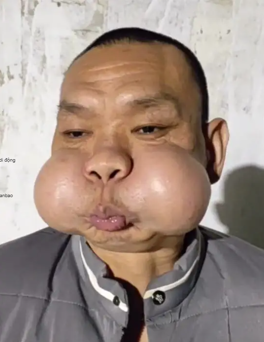 Nỗi khổ của &ldquo;ho&agrave;ng tử ếch&rdquo;- Ảnh 1.